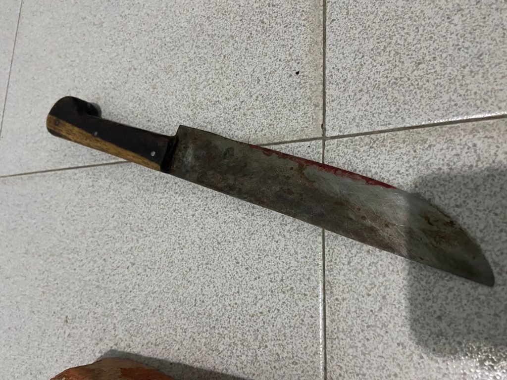 Agente policial internado en terapia tras intentar detener a una persona con cinco pedidos de capturas