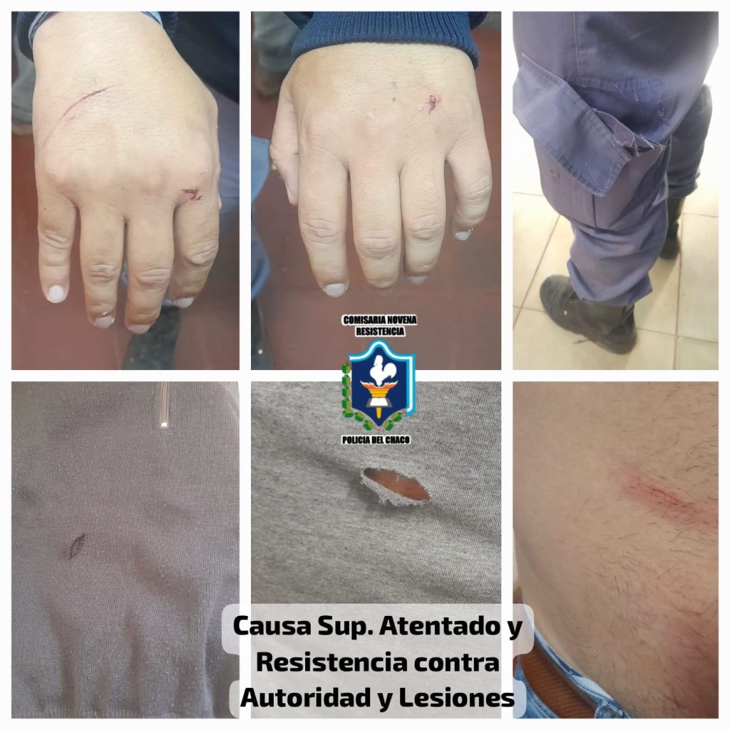 Intentó evadir a la policía, hirió a dos agentes y terminó detenido