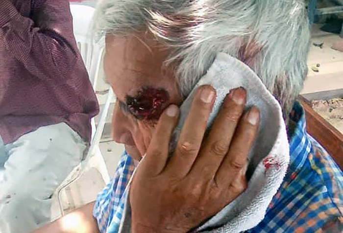 Defensoría Pública del Chaco: la represión dejó al menos 85 personas heridas en Villa Río Bermejito Defensoría Pública del Chaco: la represión dejó al menos 85 personas heridas en Villa Río Bermejito