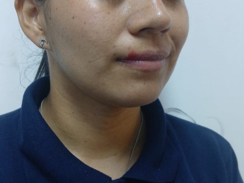 En Machagai, detuvieron a un sujeto por supuestas lesiones, resistencia y atentado contra la autoridad En Machagai, detuvieron a un sujeto por supuestas lesiones, resistencia y atentado contra la autoridad