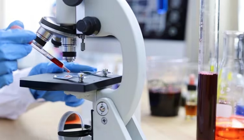 Cómo es el test que permitiría diagnosticar la enfermedad de Alzheimer con solo una gota de sangre Cómo es el test que permitiría diagnosticar la enfermedad de Alzheimer con solo una gota de sangre