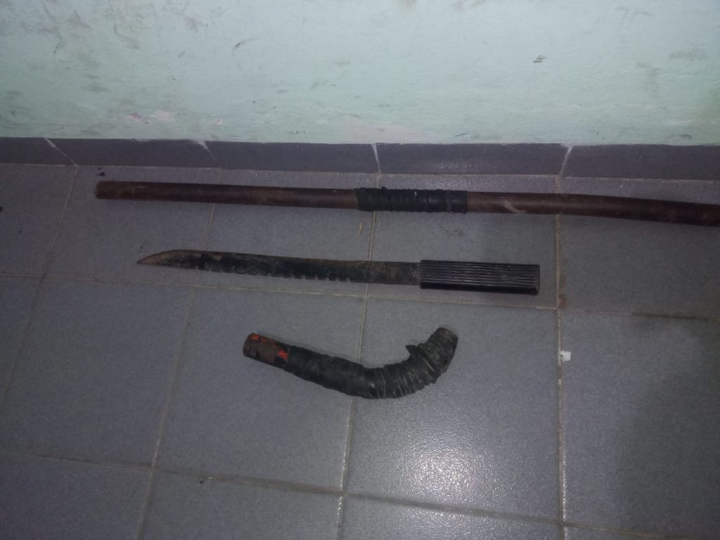 Detuvieron a un joven que hirió a otro con un arma de fuego en Fontana