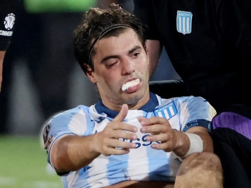 Tras un golpe de su compañero Marcos Rojo, peligra la presencia de Santiago Sosa para la revancha contra Flamengo Tras un golpe de su compañero Marcos Rojo, peligra la presencia de Santiago Sosa para la revancha contra Flamengo